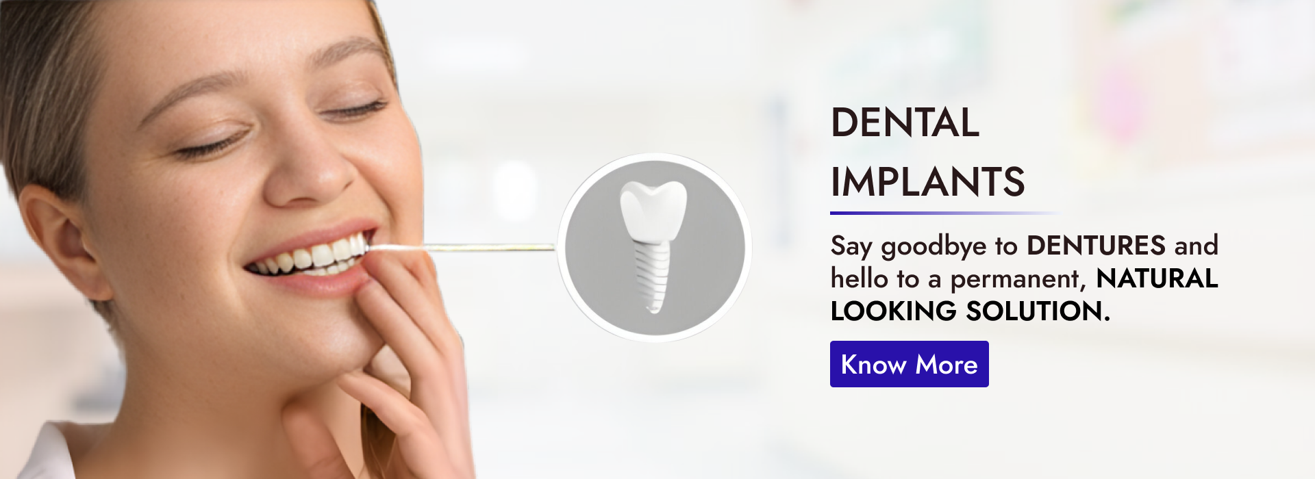 dental Implant