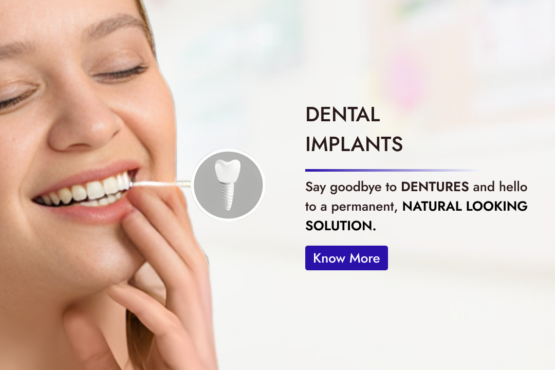 best Dental care in Bangalore