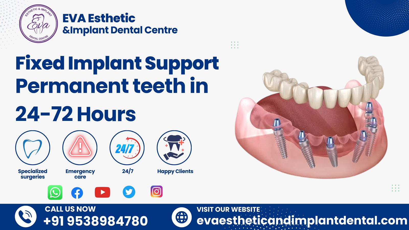 Dental implants in Bangalore